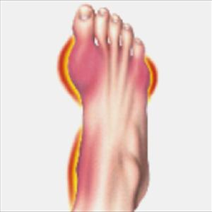  Causes, Symptoms And Treatment