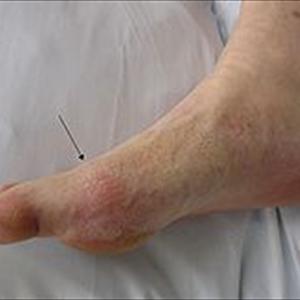 Gout Grape Juice 